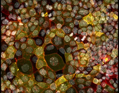 Mark W Young, Colter E. Oroke (Anseth lab) - Nikon Spinning Disk Confocal. Acquiring human tissue for study is inherently challenging, so investigators are developing lab-grown models as a surrogate. Here, researchers grew a layer of cells that simulate our intestines with the cell nuclei (gray) and membranes (red) shown. As validation of this model, some of these cells display fetal-like stem cell characteristics (yellow), just as in own intestines.