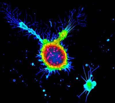 Suzannah Miller (Ahn Lab) - Nikon Spinning Disk Confocal. Melanoma is a serious form of skin cancer that, if not caught early, can rapidly spread to other organs. Understanding the 3D structure of individual melanoma cells helps researchers to discover and evaluate potential therapeutic treatments and interventions. Here, an individual cell has been modified to make the cell membrane fluorescent. The color corresponds to different heights in the cell, with warm colors indicating the top and cool colors highlighting the bottom.