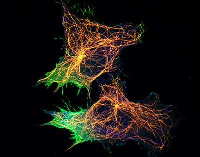 Bryan Murillo (Ahn Lab) - Nikon Spinning Disk Confocal. Cell migration is a complex process that is not entirely understood and is very relevant to cancer. Investigators are now beginning to unravel this mechanism through the identification and observation of proteins specific to this process. Here, the researchers are investigating the involvement of microtubules (flexible polymers that promote cell shape, shown in Orange) to the aggregation of specific cell migration proteins (Green).