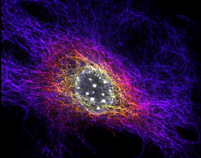 Katie Heiser (Leinwand Lab) - Nikon SDC. Microtubules are tubular aggregates of proteins that are involved in a number of cellular processes. Here the microtubules of a mouse embryo are colored according to their location with this 3D image, with the cell nucleus shown in grey. The ability to observe such fine structures in 3D allows researchers to image nearly every facet of the cell, leading to a myriad of discoveries.