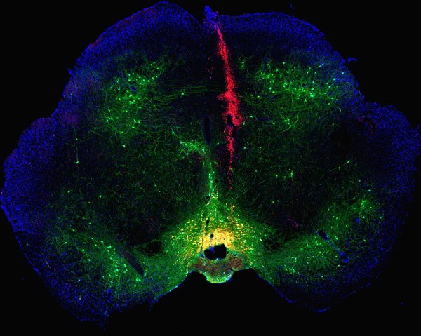 Fluorescently-labeled mouse brain. The brain's reward center (yellow) becomes visible (green) upon stimulation. The cell nuclei (blue) and the injection site (red) are also observed. Taken by Alysa Phillips.