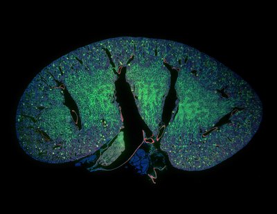 Joe Dragavon (ALMC) - Nikon SDC.  It is often desirable to observe a very large object with microscopic resolution. In microscopy, this can be accomplished through the complex synchronization of automated stages, light sources, and cameras. Here, an entire mouse kidney cross-section was imaged using more than 2500 individual images. Individual components of the mouse kidney are shown in green and red, while the numerous nuclei are blue.