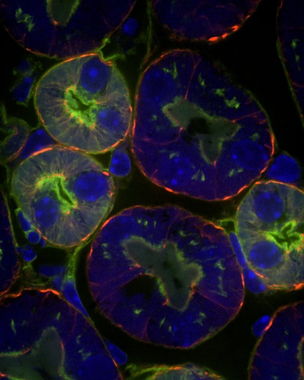 Mouse kidney cells at 100x magnification. Green - glomeruli, Red - actin filaments, Blue - cell nuclei. Taken by Jian Wei Tay.