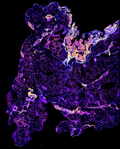 Doug Peters (Garcea Lab) - Nikon Spinning Disk Confocal. The development of a viable drug or vaccine is incredibly difficult and requires a thorough investigation of many tissues and organs to identify any adverse physiological effects. Many mammalian tissues are naturally fluorescent, providing a colorful backdrop to which negative impacts can be identified and observed. Here, researchers are looking at a section of a mouse spleen for signs of an immune response. The spleen’s natural fluorescence yields colors that combine to give the resulting image.