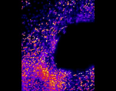 Lindsey Joe Broadwell (Leinwand Lab) - Nikon Spinning Disk Confocal. Stem cells are versatile and essential tools for today’s investigators as they can be differentiated into many different cell types. Furthermore, growing these cells in 3D environments in large part emulates what is found within our bodies. Here, the nuclei of cardiac muscle cells that have been differentiated from stem cells (in orange) are observed, showing their location within a 3D matrix (in purple). These capabilities are important for simulating the development of our hearts and have had profound implications for studying and treating heart disease.