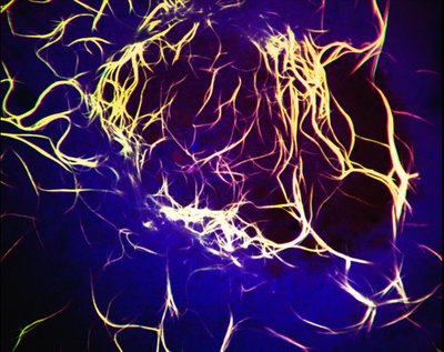 Chicca and Massimo Buvoli (Leinwand Lab) - Nikon SDC. Myosin proteins are essential for muscle contraction. In non-muscle cells, these proteins form long filaments. In this environment, researchers can investigate the interaction of multiple proteins that are fluorescently labeled. Here, three proteins are investigated and independently labeled as blue, green, and red. The resulting yellow filaments suggest that the red and green proteins strongly interact, while the blue protein does not.