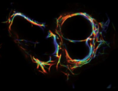 Chicca and Massimo Buvoli (Leinwand Lab) - Nikon SDC. In this image, bundles of myosin filaments (in green and red) and its chaperone protein (blue) are shown. Myosins are the motor proteins that power muscle contraction. The study of myosin filament assembly can provide powerful insights into the treatment of defects in heart and skeletal muscle.