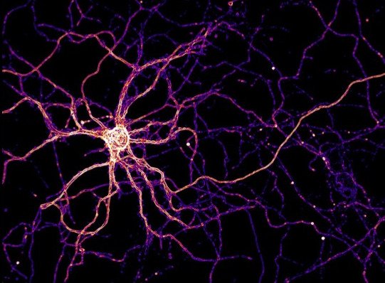 Hippocampal neuron expressing a fluorescent zinc sensor. Taken by Lynn Sanford.