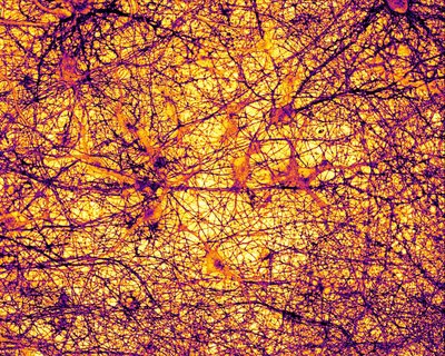 Lynn Sanford (Palmer Lab) - Nikon SDC. Our brains are a complex interwoven network of neurons and other cell types that work together to transmit information through neurotransmitters such as glutamate and zinc. The network shown here has been labeled with a membrane-bound dye that allows us to observe zinc release upon neuronal activation. The resulting image has been pseudocolored based on fluorescence intensity.