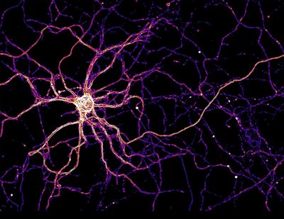 Lynn Sanford (Palmer Lab) - Nikon SDC. Hippocampal neurons use zinc as a neurotransmitter, but it is difficult to see zinc dynamics in cells. To overcome this challenge, primary hippocampal neurons can be genetically modified to express a fluorescent zinc sensor to measure zinc dynamics in real time. The image shown here is an example of one such modified neuron colored to show zinc sensor expression levels.