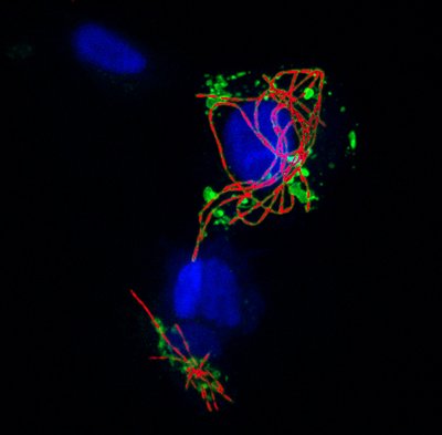 Mike Minson (Palmer Lab) - Nikon SDC. The cells in this image have been infected with the bacteria Salmonella (in red), with some proteins from the invasive bacteria shown in green. The nucleus of each host cell is in blue. Witnessing how bacteria are spreading allows us to directly observe a specific response to the bacteria, and helps to identify new antibacterial targets for drug treatment.