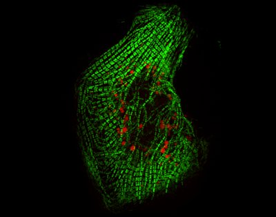 Chicca Buvoli/Massimo Buvoli (Leinwand Lab) - Nikon Spinning Disk Confocal. A tight network of sarcomeres, the contractile units of muscle, exists in the vast majority of heart cells. The major player of this contractile machinery is the myosin motor (in green). It is important that the correct interaction between myosin and other proteins occurs, allowing for efficient contraction and proper cardiac function. Here, a mutated molecule (in red) that does not form the correct complex with myosin is shown. This finding will allow investigators to better understand the pathological effect of this and similar mutations that cause heart disease.