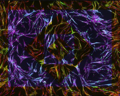 Meghan Schroeder (Anseth Lab) - Nikon SDC. At the cellular level, heart disease of the aortic valve can be characterized by the presence of stiffness and stress fibers. This can be induced and observed in the lab, allowing researchers to gain an increased understanding of heart disease. Stress fibers grown on a stiff matrix are shown in this image under two different color sets. Warm tones: Nuclei (blue), Stress Fibers (red), Normal Fibers (green); Cool tones: Nuclei (green), Stress Fibers (blue), Normal Fibers (magenta).