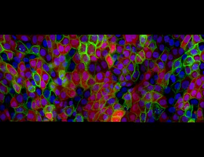 Erik Bunker (Liu Lab) - Nikon SDC. Live-cell microscopy allows us to monitor cell division as it relates to wound healing in skin cells. Using this technology, researchers can observe parameters such as a cell growth regulator (red), a membrane-bound sensor for cell communication (green), and the nucleus of each cell (blue). Observing these parameters can increase our understanding of cell division under normal and cancerous conditions, leading to the identification of novel cancer-specific targets for drug development.