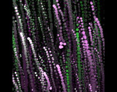 Dylan Parker (Parker lab) - Nikon W1-SoRa. Biomolecular condensates are minute subcellular compartments consisting of proteins or DNA or RNA and are involved in many cellular processes. How these condensates self-organize remains an open question. In this image, investigators are studying how RNA can scaffold biomolecular condensates.
