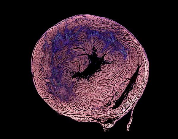 Cross-section of a rat heart after a heart attack. Fibrosis, cardiac scarring, is shown in blue and a drug delivering molecule is shown in green. Taken by Manuela Garay-Sarmiento and Chima Maduka.