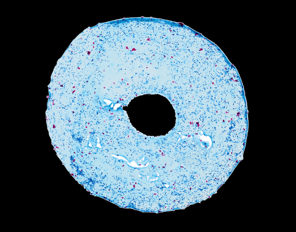 Cross-section of a hydrogel with stem cells that lay down cartilage protein (dark blue). Taken by Laurel Stefani.