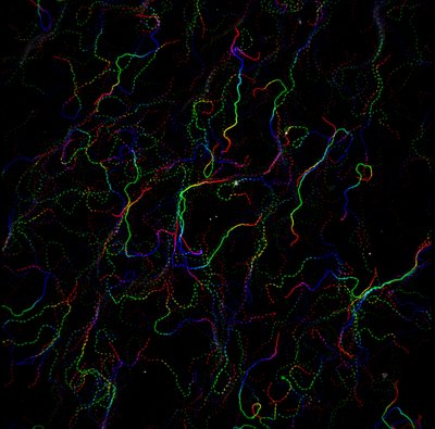 Anastasia Karabina (Leinwand Lab) - Nikon Widefield. Personalized medicine aims to deliver more precise and effective medications to combat a given disease. However, for this to be successfully achieved, the diseased cells must be characterized. Shown here is an example of actin propagation over time (time is color coded from Blue to Red), whereby the investigator can follow this crucial subcellular component of muscle cells and label it as healthy or diseased. If needed, the appropriate medication can then be selected and applied.