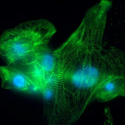 Yicheng Long (Cech Lab) - Nikon Widefield. Acquiring relevant human tissues to study human diseases is challenging, meaning researchers are often required to use non-ideal models. More recently, investigators have been able to utilize pluripotent stem cells in their disease studies. These cells can be induced to represent nearly any human cell type or tissue. Here, stem cells have been induced to form human cardiac myocytes. Muscle components are shown (Green). The individual cell nuclei are also shown (Blue).