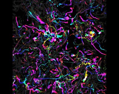 Sam Holtzen, Maria Lo (Palmer lab) - Nikon Widefield. The element zinc is essential for proper cellular function. In people, zinc deficiency can lead to hair loss, eye problems, and increased infections. At the cellular level, reduced zinc levels may result in DNA damage. Here, zinc-deficient cells are observed over time to examine their motility. Each color is the path an individual cell took over 48 hours.