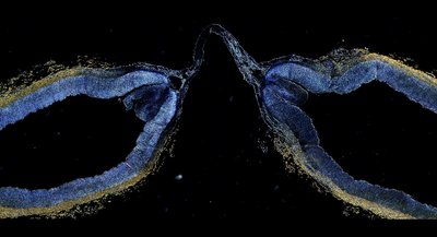 Eric Kramer (Rentschler Lab) - Nikon WF. This image allowed us to observe the changes in collagen (the primary support structure for our arteries) once a specific medical device had been used to seal an artery. Researchers observed the effectiveness and efficiency of the tool, by color-coding the native pre-procedure collagen (colored), and the denatured post- procedure collagen (transparent), which may ultimately help in the development of minimally invasive medical devices.