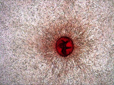 Megan E. Schroeder (Anseth Lab) - Nikon Widefield. Over time, heart valves may develop unwanted nodules of calcium that can lead to the stiffening of our heart valves. Researchers have developed laboratory models to study the formation of such nodules. Here, cells from a male heart valve are shown forming a calcified nodule (in red), much like what happens in the heart when the soft tissue calcifies with disease. Understanding how these cells from the heart form bone-like nodules allows researchers to begin to understand sex differences in heart valve disease.