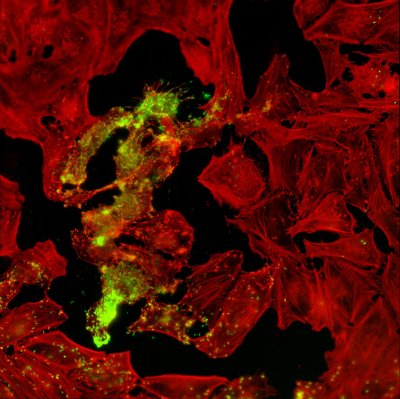 Dilara Batan (Palmer Lab) - Nikon WF. This image shows individual Listeria bacteria in green and the cellular cytoskeleton of host cells in red. As the initial invasive bacterium gains a foothold within a host cell and multiplies, its daughter cells can escape the host cell and infect neighboring cells. The direct observation of the spread of bacteria can lead to the discovery of new treatments for bacterial infections.