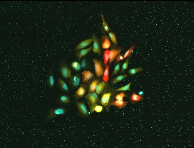 Kelsie Anson (Palmer Lab) - Nikon Widefield. Researchers now understand that zinc and other metals play a vital role in proper cellular function. Genetically-encoded tools can be used to observe the connection between these metallic nutrients and changes in cell behavior. Here, these cells have been modified to show the presence of zinc (Yellow) and other traditional signaling molecules (Red), providing insight to their physiological relationship. The individual cell nuclei are shown (Teal).