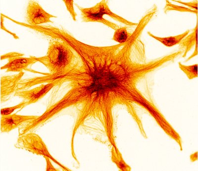 Tristan Caro, Adam Dziulko, and Sharon Wu (IQBiology graduate students) - Nikon Widefield. Microtubules are part of the 'cytoskeleton' which gives a cell its structure and shape. Like mini superhighways, microtubules enable the transport of products throughout the cell. Because microtubules are so essential, malfunctions in microtubules are suspected to be the root of various degenerative diseases. Understanding how microtubule assembly impacts cell function can help researchers pinpoint the causes of these diseases. Here, the complex networks of microtubules within an arterial cell are visible (orange to black), whereas the cell membrane can be seen in faint yellow.