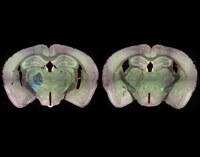 Myriam Moreno Garcia (Alex Whiteley lab) - Nikon Widefield. The brain is one of the most fascinating, yet least understood, organs in our bodies. However, direct functional observation is challenging due to the intricate network of cells, neurons, and other structures and its extreme density. Here, the researchers visualized the ubiquitous presence of a protein (white) throughout sequential mouse brain slices, with the natural glow also visible (green and blue).