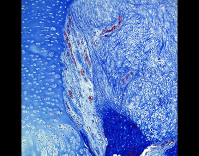 Sarah Schoonrad (Bryant lab) - Nikon Widefield. Studying images of damaged tissues provides important information for developing new regenerative approaches. This is a section of pig cartilage that was stained with the dye Masson’s Trichrome, distinguishing cells (dark red) from structurally different collagens (varying shades of blue). Though this method was developed one hundred years ago, variations of it are still widely used today.