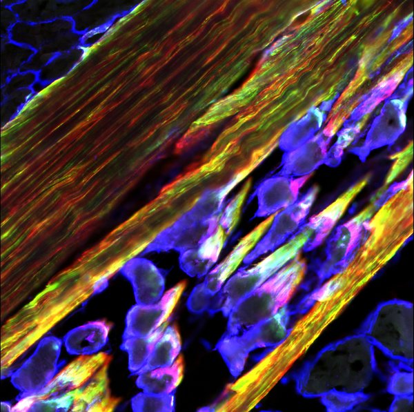 Interface between tendon (green and red) and muscle (blue). Taken by Sarah Lipp.