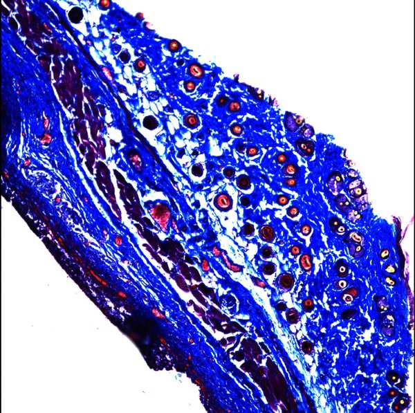Cross-section of tissue next to an implanted material. The dark purple layer in the lower left shows excess inflammation, which developed next to the implant. Taken by Brittany J. Thompson.