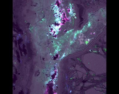 Jacob Tidwell, Carson Cucarola, and Srishti Kashyap (Templeton Lab) - Nikon Widefield. While fluorescence microscopy is commonly applied to biological systems, it can even benefit fields such as geology. Here, a fluorescent image of a paper-thin sliver of serpentinite rock is shown, with its various materials and sub structures now visible to investigators. These rocks host microscopic life on Earth but are also found throughout the solar system and may be key to discovering life on other planets.