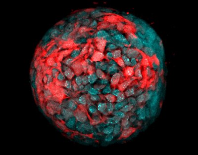 Michael Blatchley (Anseth Lab) - Zeiss LSM710 Laser Scanning Confocal. Lab-grown mini-organs, termed organoids, look and function like their native tissue counterparts. These organoids hold great promise as platforms for drug testing and as building blocks for transplantable tissues. However, organoids grow in an unpredictable manner that limits their translational potential. One way to control how organoids grow is to control the environment that surrounds them. In this image, researchers are investigating how the proteins (red) produced by the cells within the organoid (teal) can control organoid growth.