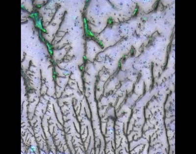 Bruce Kirkpatrick, Meagan Arguien (Anseth and Bowman labs) - Zeiss LSM 710. Synthetic elastic materials that mimic human tissue allow investigators to develop more accurate laboratory models of development and disease. However, these materials sometimes fail during production. Visualizing the structural irregularities, such as the differences observed here from the top to the bottom of the image, can help us understand these faults and inform better material design.