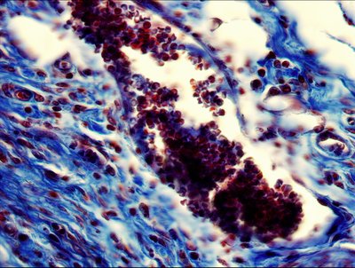 Leila Saleh (Bryant Lab) - Zeiss Widefield. Researchers aim to develop new materials that provide greater medical benefit and functionality while being readily accepted by our immune systems. By observing the tissue that surrounds the engineered material, investigators can assess the biocompatibility of the material with our bodies. In the tissue section shown here, the connective tissue (Blue) and cell nuclei (dark red) can be seen.