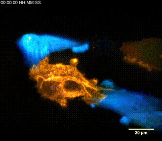 Orange cell surrounded by smaller blue cells.
